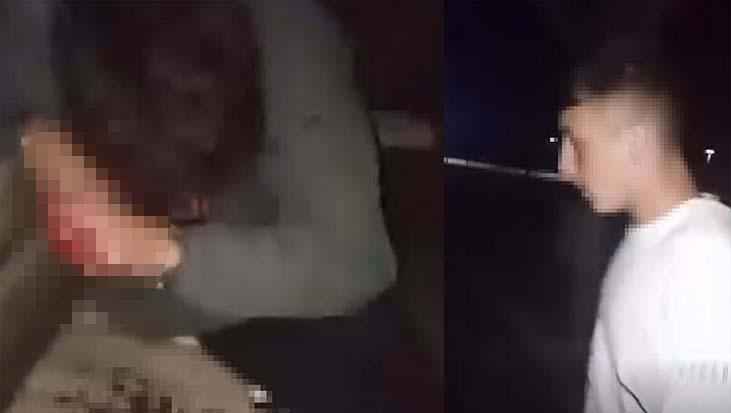 lise ogrencileri arasinda kanli kavga arkadasini parka cagirarak darbetti WERfj1K2